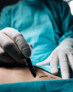 o que ninguém te explica sobre cirurgia plástica