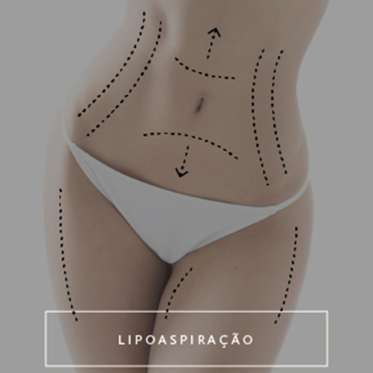 1839943ca1d7cc0fe10ce4af411c1de21-1